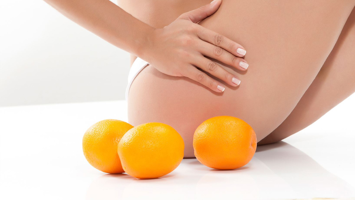 Прибрати целюліт