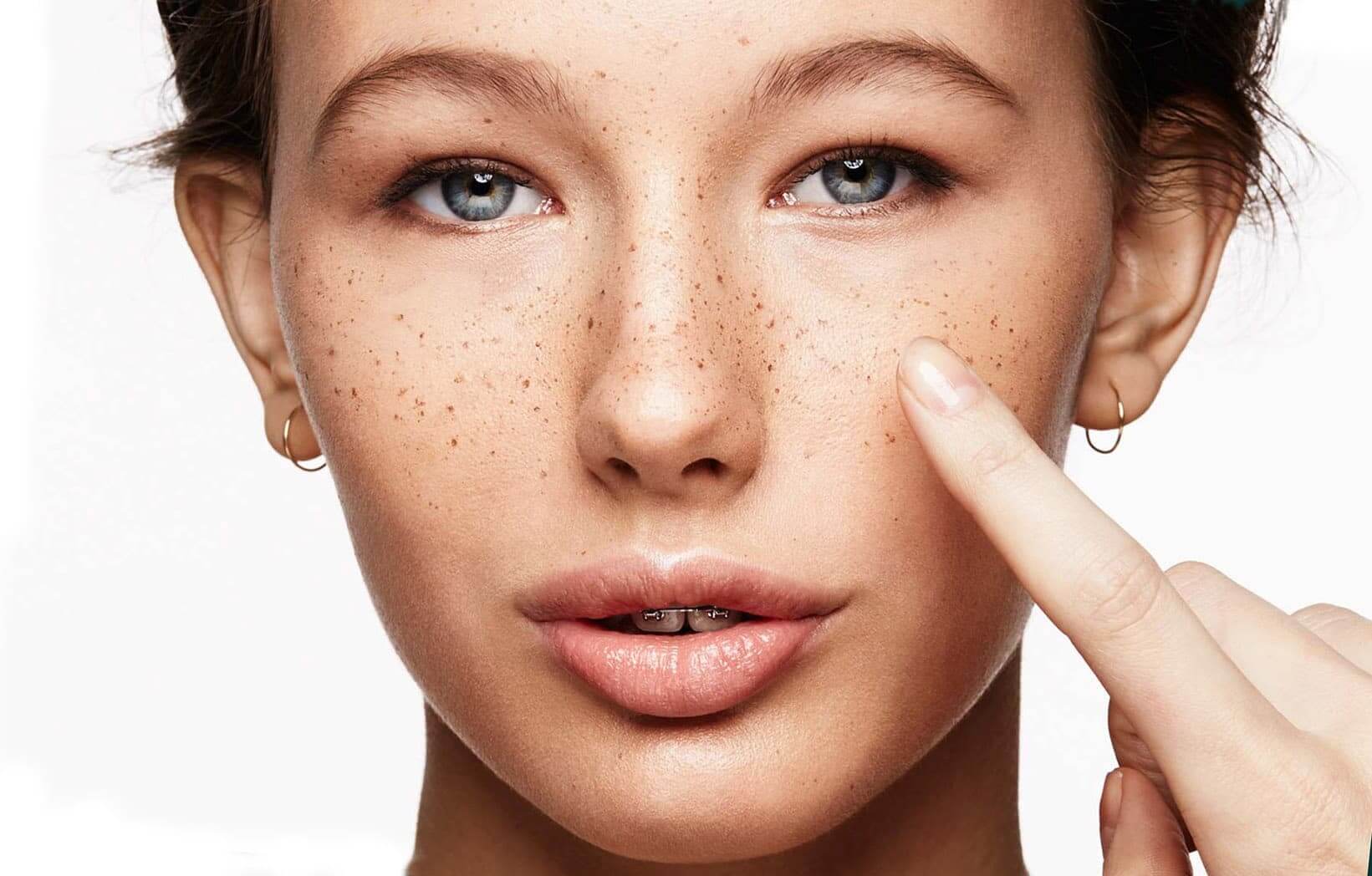 Висвітлити пігментні плями