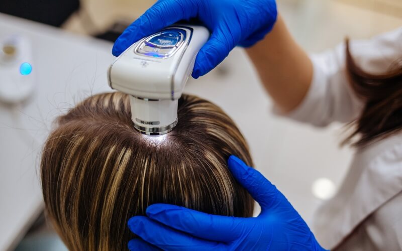 Трихоскопія на ASW 300