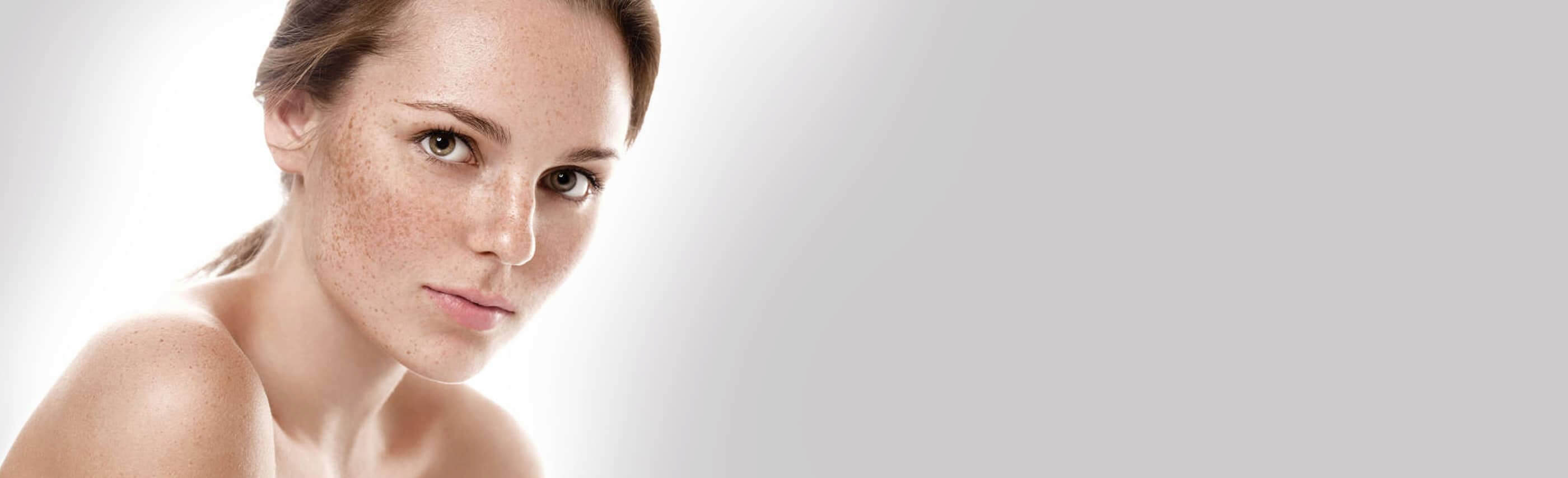 Лікування гіперпігментації