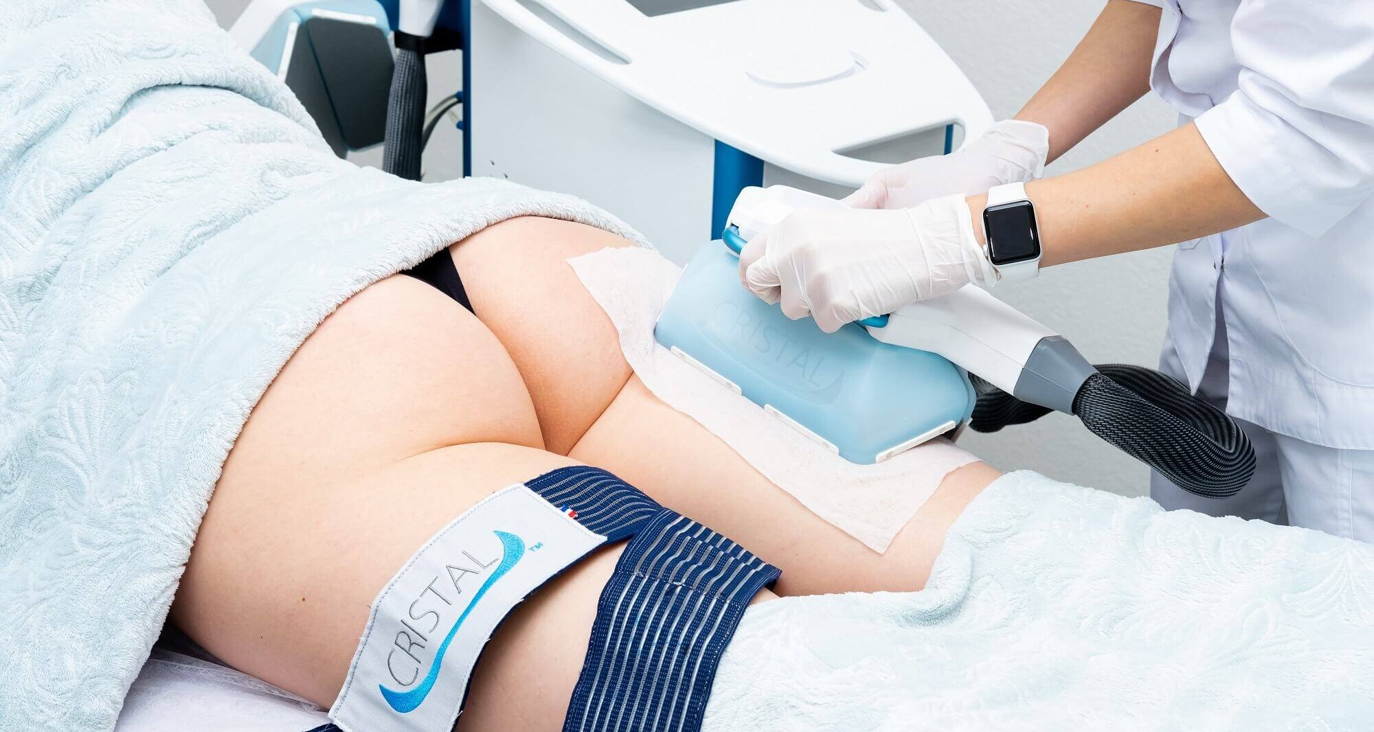 Кріоліполіз Cristal