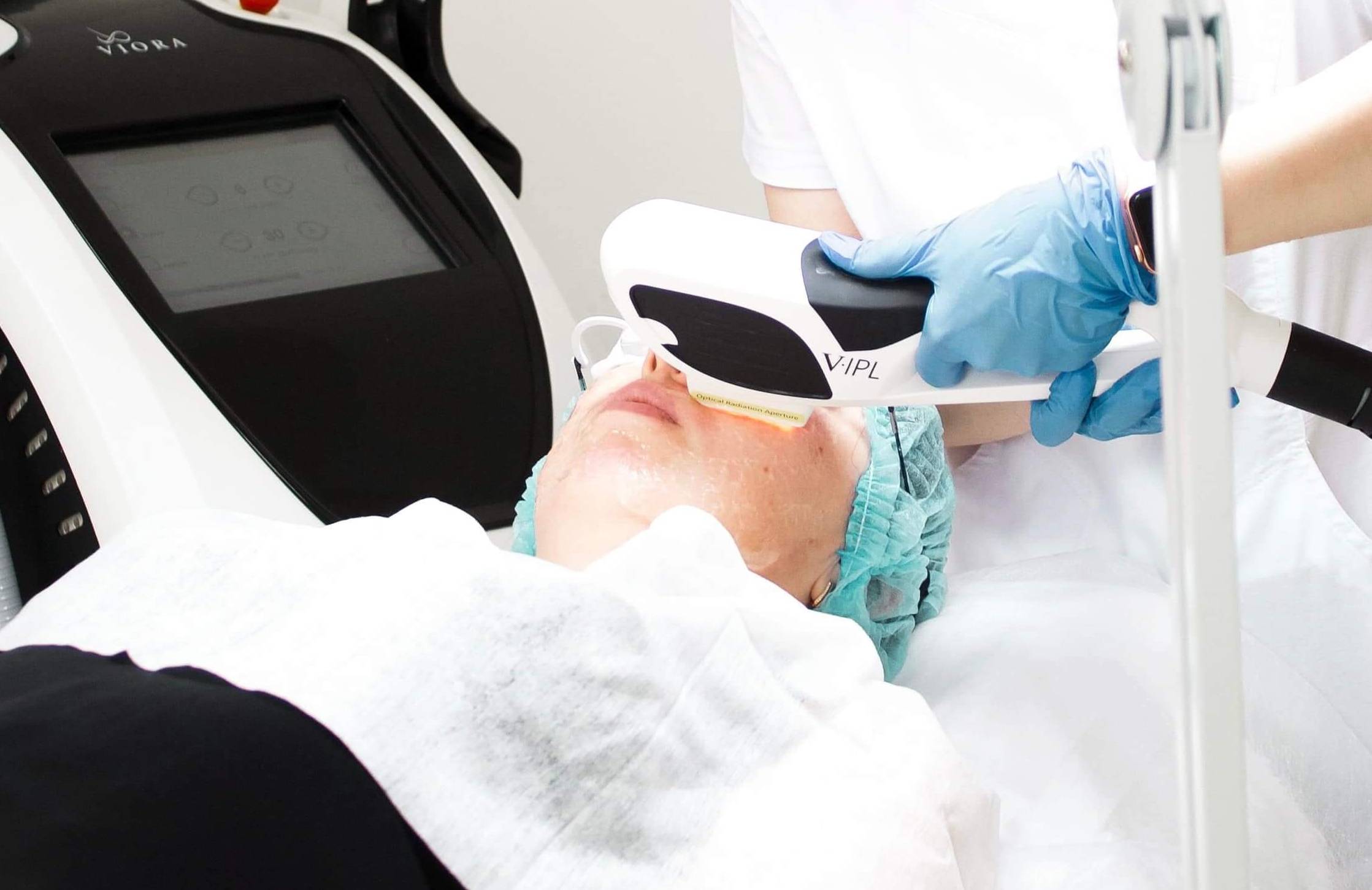 Фототерапія IPL