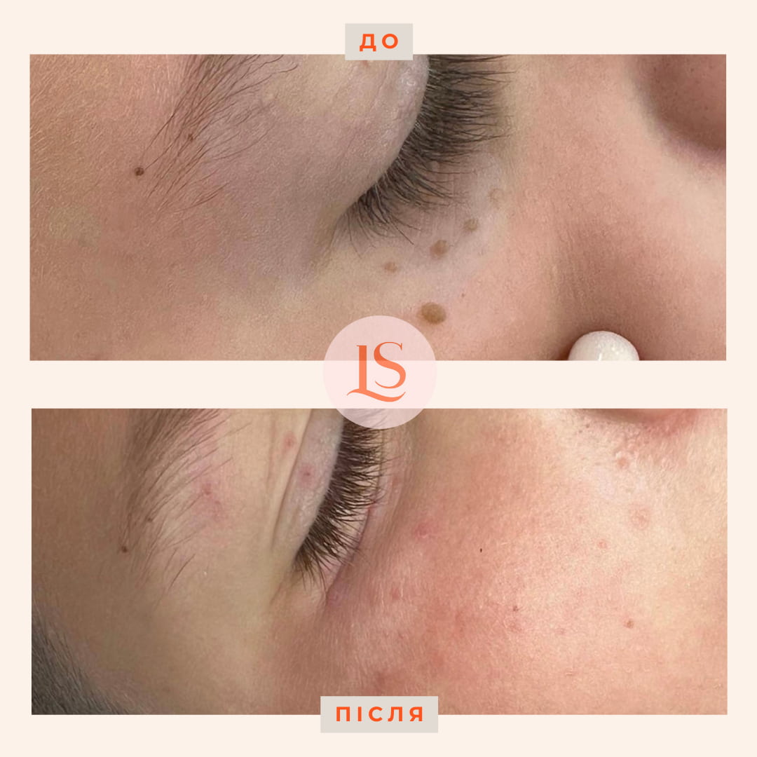 Дерматохірургія-_1