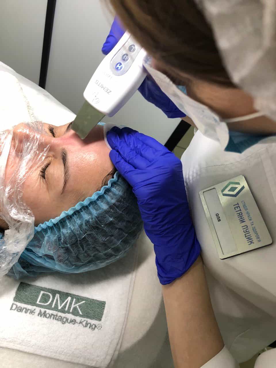 Ультразвукова чистка обличчя-_1