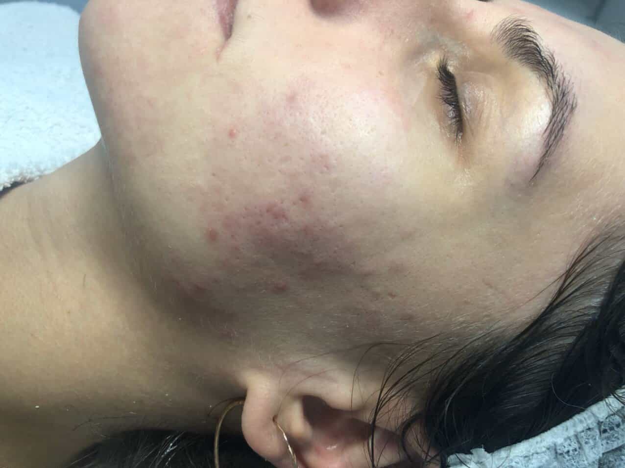 Ультразвукова чистка-_2