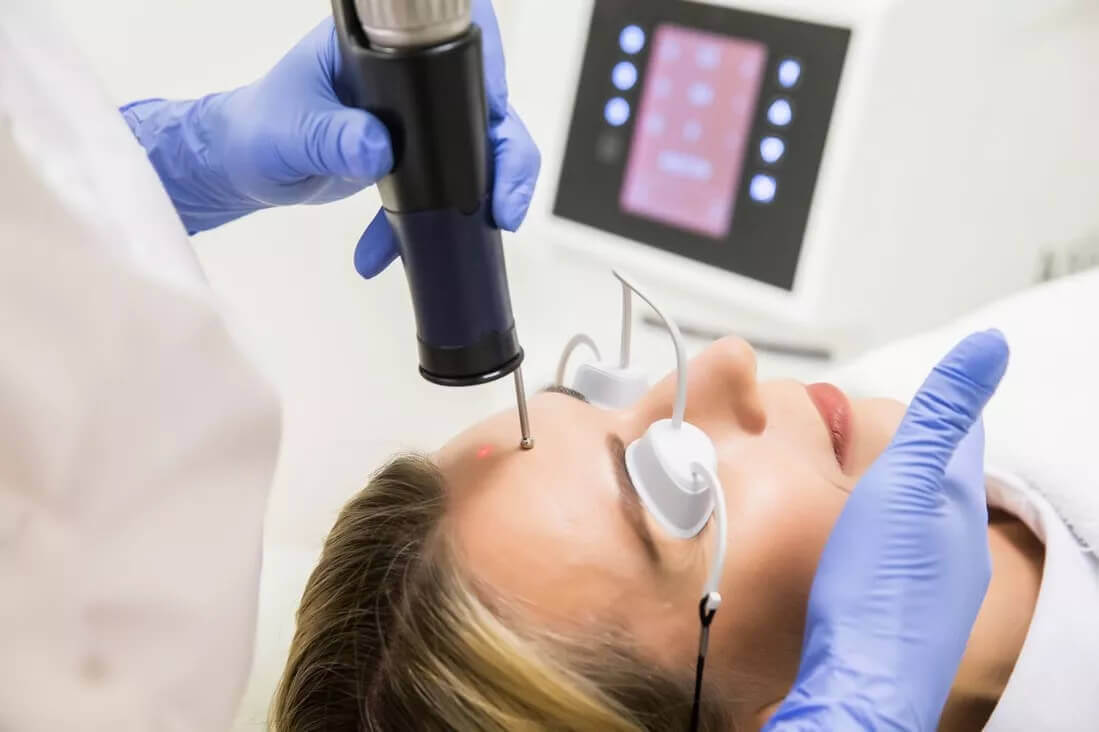 Шліфування шкіри Dermablate New